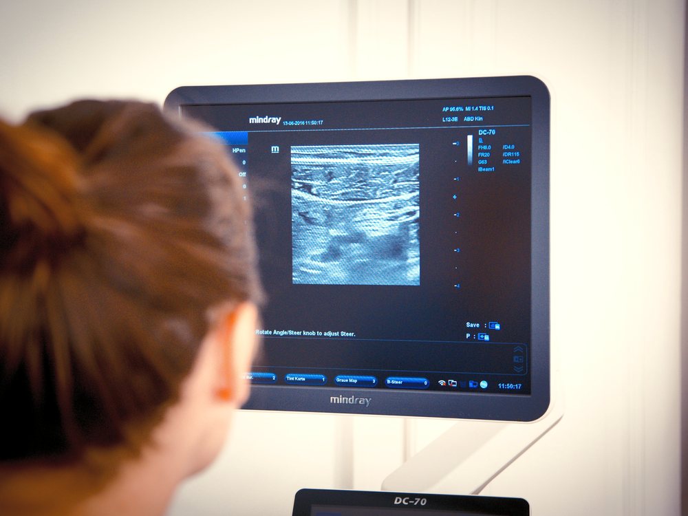 Ultraschallbild am Monitor während der Untersuchung